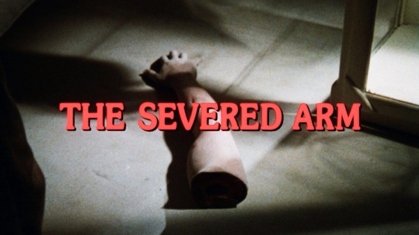 The Severed Arm